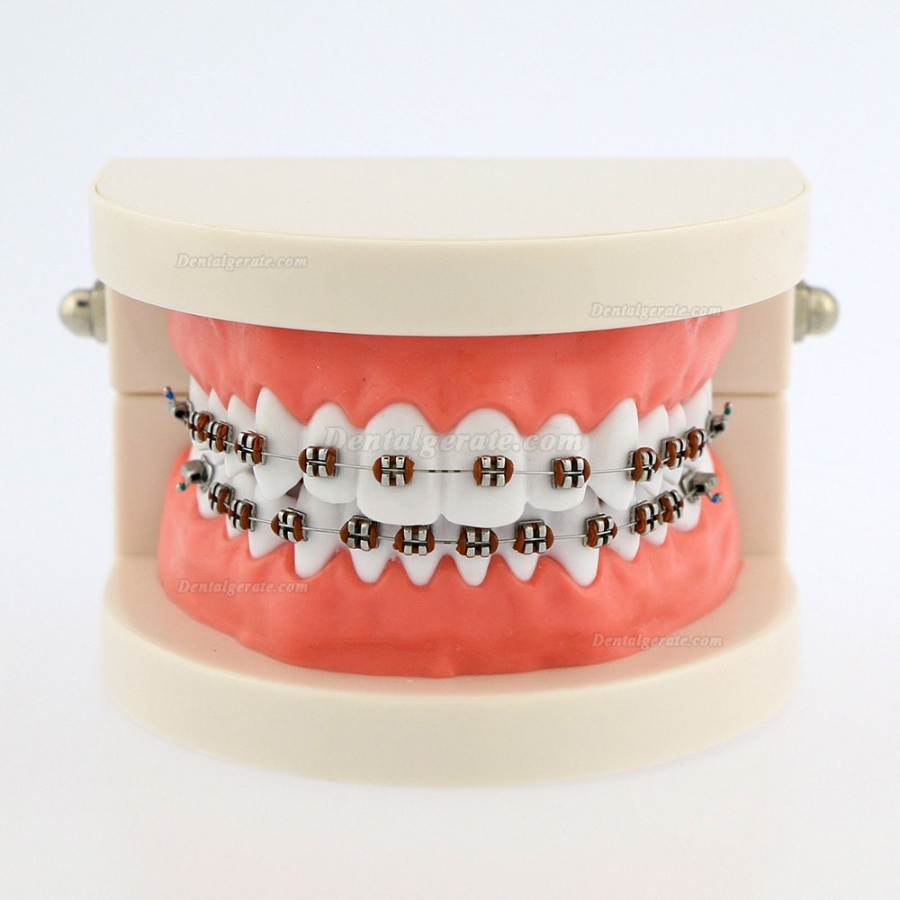 Dental Teach Typodont Demonstrationszahnmodell mit Zahnspangen F&uuml;r die Patientenstudie 5006